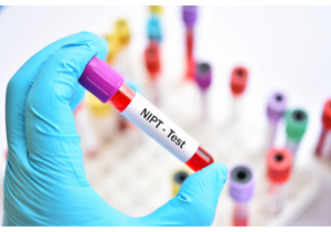 badanie prenatalne nipt, badania prenatalne nipt, test prenatalny nipt